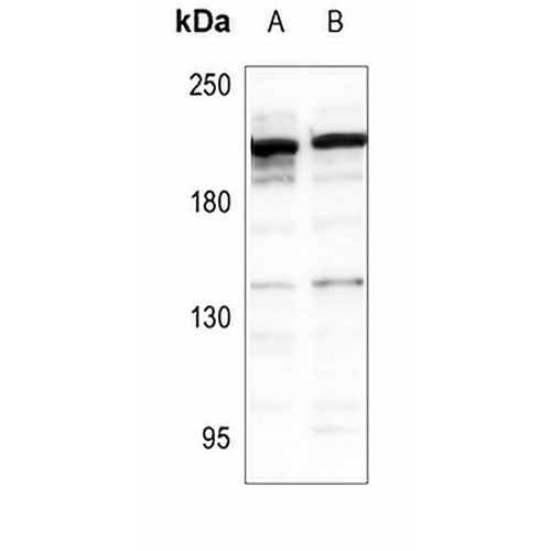 Carboxypeptidase D Rabbit Polyclonal Antibody