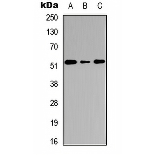 Cathepsin C HC Rabbit Polyclonal Antibody