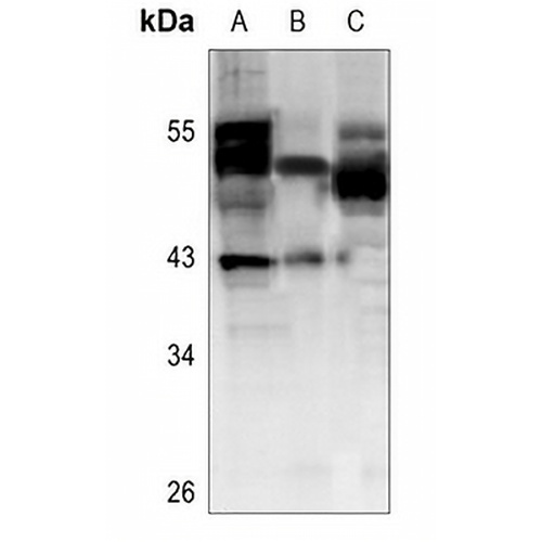 Cathepsin F Rabbit Polyclonal Antibody