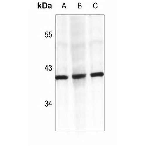 Cathepsin K Rabbit Polyclonal Antibody