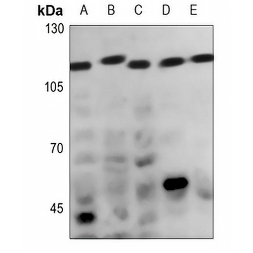CATSPER1 Rabbit Polyclonal Antibody