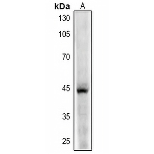 CD123 Rabbit Polyclonal Antibody