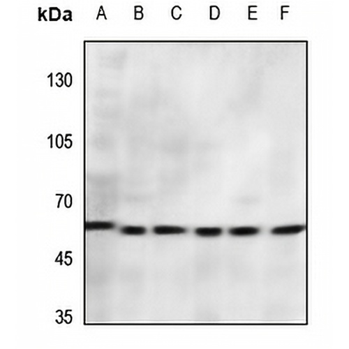 CD156a Rabbit Polyclonal Antibody