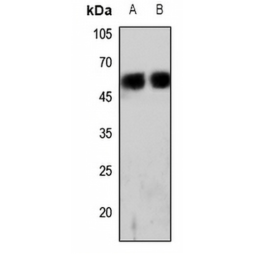 CD224 HC Rabbit Polyclonal Antibody