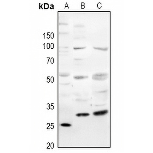 CD354 Rabbit Polyclonal Antibody