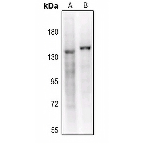 CD41 HC Rabbit Polyclonal Antibody