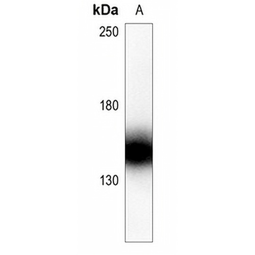Collagen 5 alpha 2 Rabbit Polyclonal Antibody