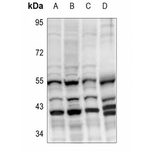 Cytochrome P450 27C1 Rabbit Polyclonal Antibody
