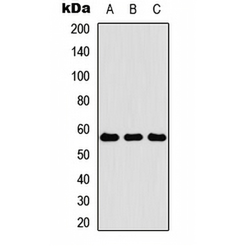 Cytokeratin 4 Rabbit Polyclonal Antibody