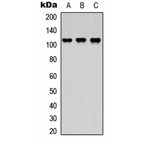 DDEF2 Rabbit Polyclonal Antibody