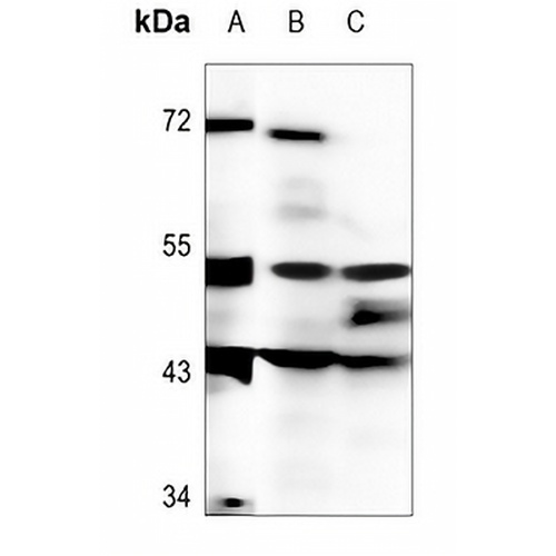 DMRTA1 Rabbit Polyclonal Antibody