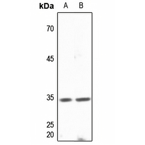DNAJB2 Rabbit Polyclonal Antibody