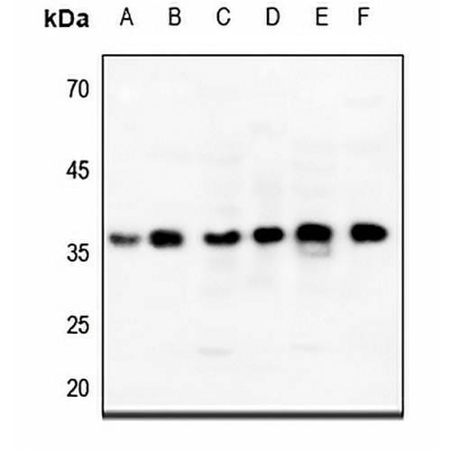 ENT2 Rabbit Polyclonal Antibody