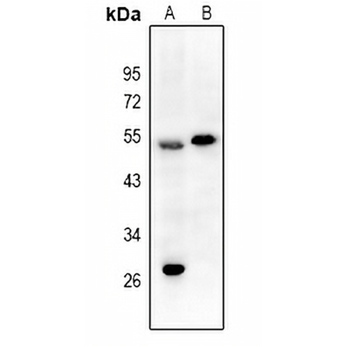 EPX HC Rabbit Polyclonal Antibody