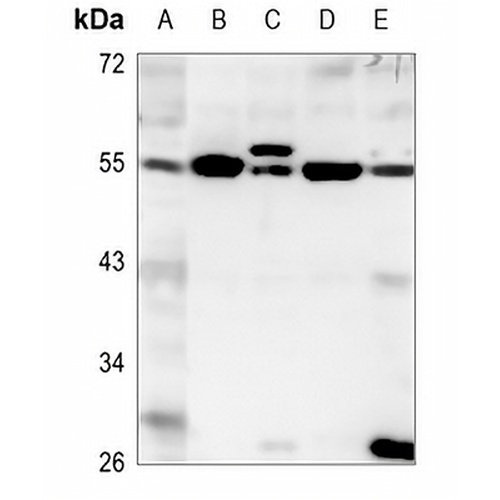 EYA1 Rabbit Polyclonal Antibody