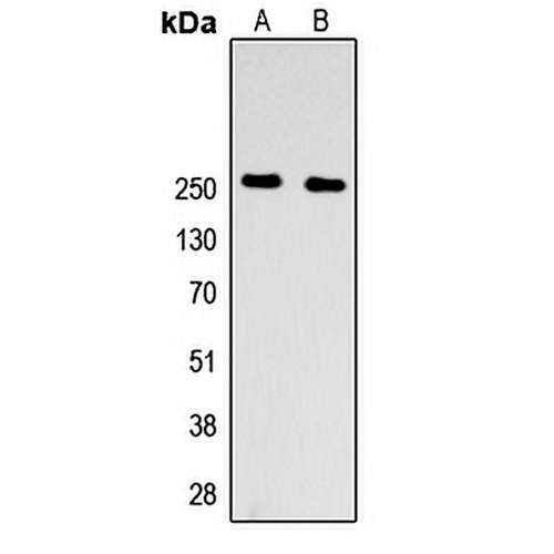 Factor V HC Rabbit Polyclonal Antibody