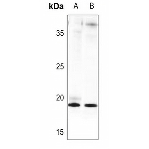 FGF4 Rabbit Polyclonal Antibody