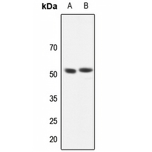 GABRR1 Rabbit Polyclonal Antibody