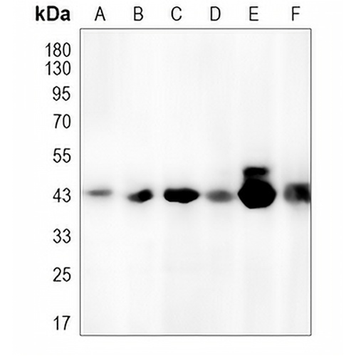 GALR1 Rabbit Polyclonal Antibody