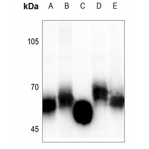 GGT5 HC Rabbit Polyclonal Antibody