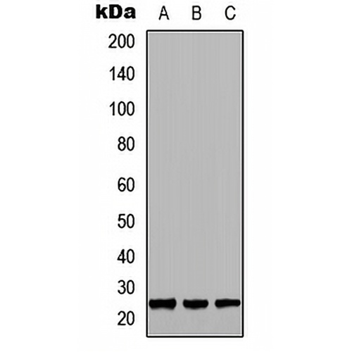 GH1 Rabbit Polyclonal Antibody