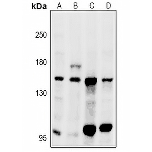 GPR116 Rabbit Polyclonal Antibody