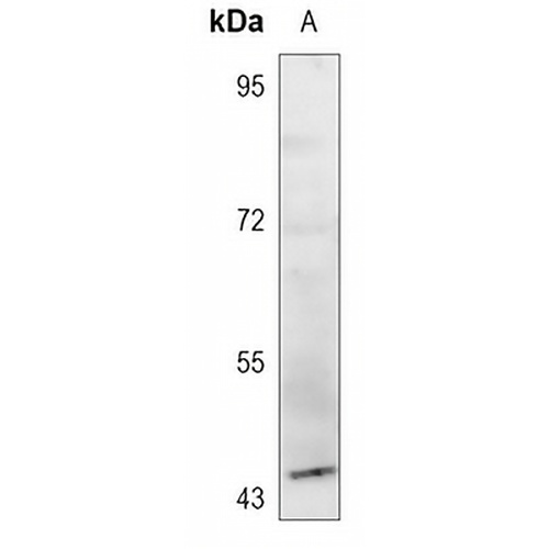 GPR143 Rabbit Polyclonal Antibody
