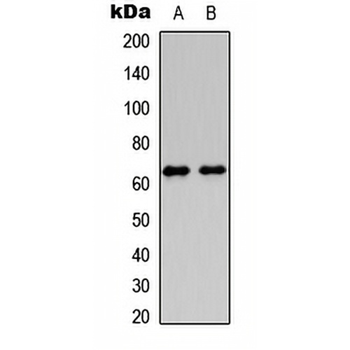 HABP2 HC Rabbit Polyclonal Antibody