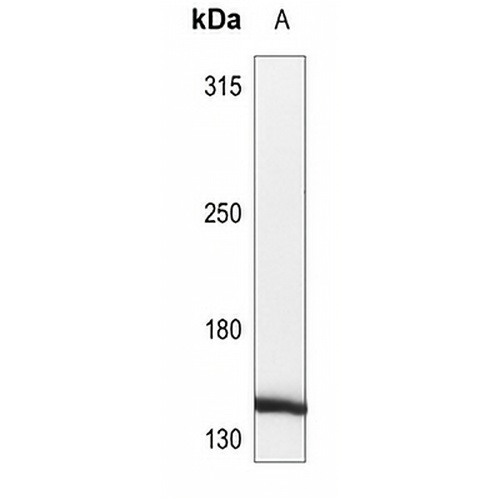 HCAP (Phospho-S1083) Rabbit Polyclonal Antibody