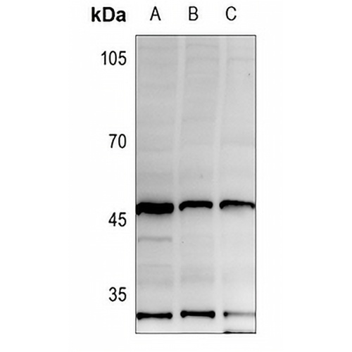 HLA-A/B/C Rabbit Polyclonal Antibody