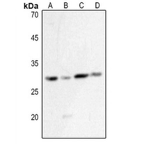 HLA-DQB1 Rabbit Polyclonal Antibody