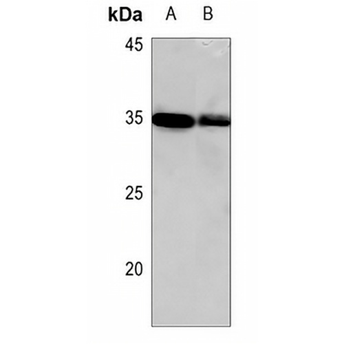HOXC8 Rabbit Polyclonal Antibody
