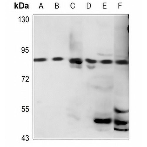 HSD17B4 Rabbit Polyclonal Antibody