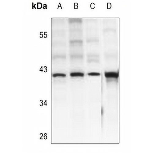 IDH3 beta Rabbit Polyclonal Antibody