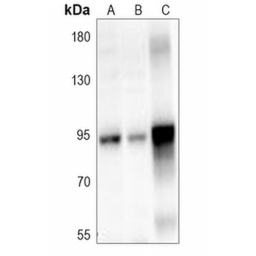 ITIH3 Rabbit Polyclonal Antibody
