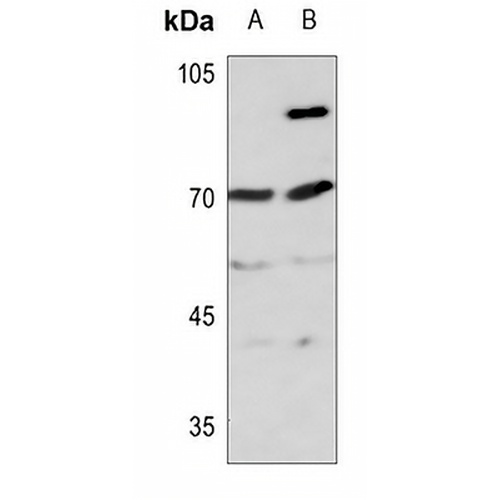 ITIH4 70k Rabbit Polyclonal Antibody
