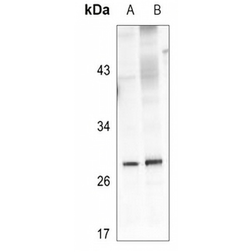 Kallikrein 4 Rabbit Polyclonal Antibody