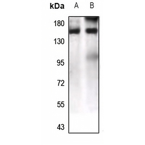 LPHN1 Rabbit Polyclonal Antibody