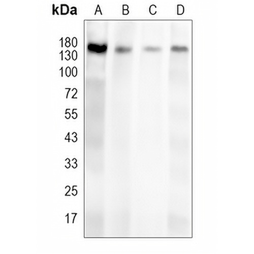 LPHN2 Rabbit Polyclonal Antibody