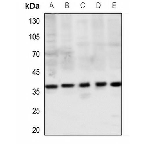 MAS1L Rabbit Polyclonal Antibody