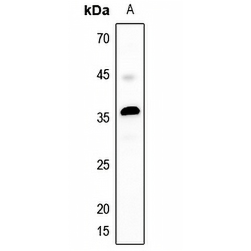MASP1 LC Rabbit Polyclonal Antibody