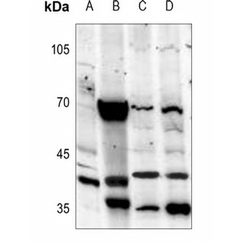 Melatonin Receptor 1a Rabbit Polyclonal Antibody