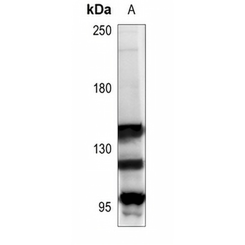 mGLUR1 Rabbit Polyclonal Antibody