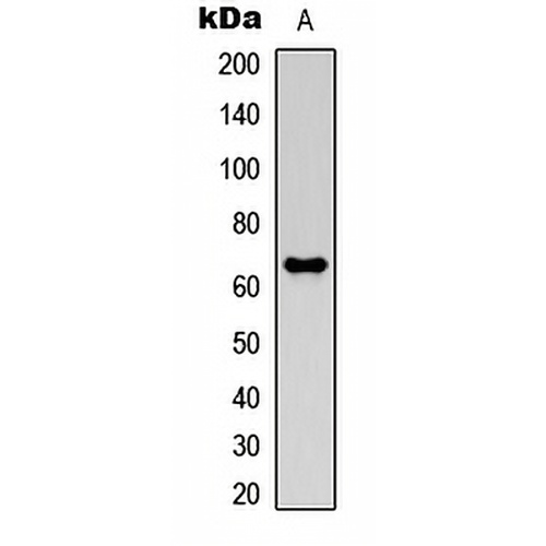MMP21 Rabbit Polyclonal Antibody