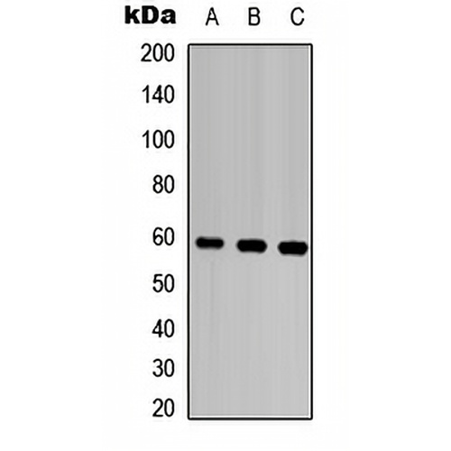 MMP28 Rabbit Polyclonal Antibody