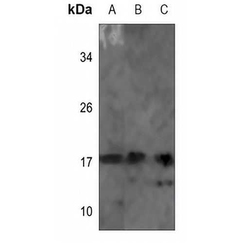 NDUFB7 Rabbit Polyclonal Antibody