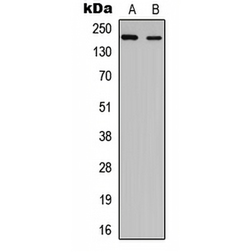 NUP210L Rabbit Polyclonal Antibody