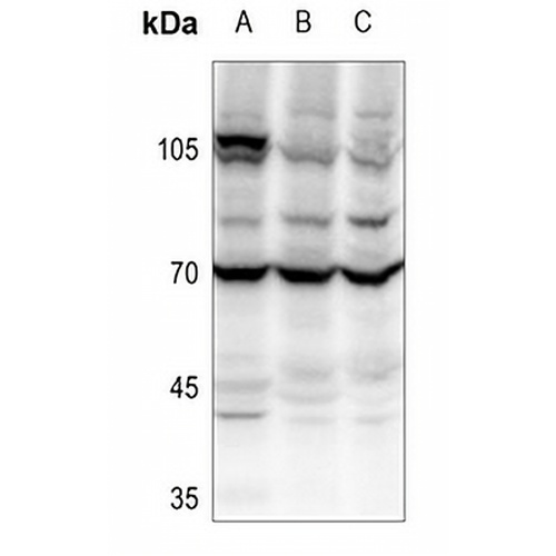 SLC22A1 Rabbit Polyclonal Antibody