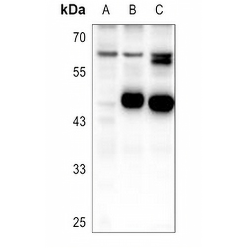 PDP1 Rabbit Polyclonal Antibody