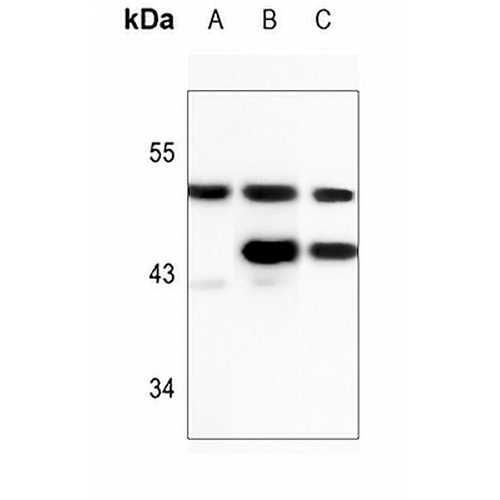 PICK1 Rabbit Polyclonal Antibody